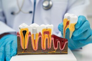 Riesgo de padecer enfermedad periodontal