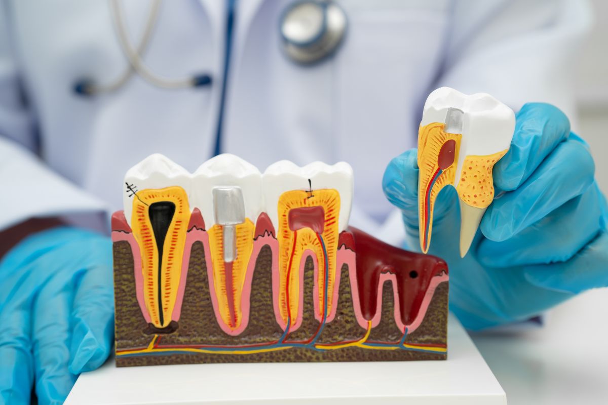 Riesgo de padecer enfermedad periodontal
