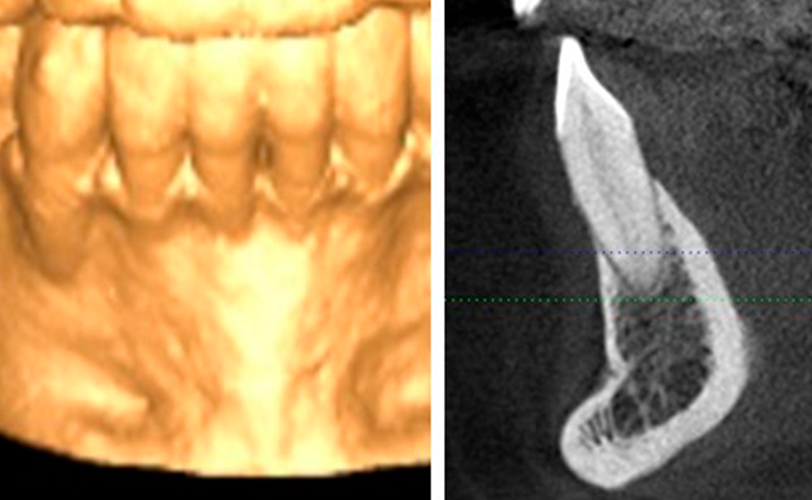 diagnostico radiologia 3d