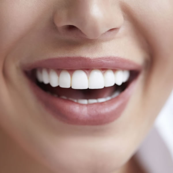 Blanqueamiento dental en Granada