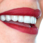 Una mujer vuelve a sonreír sin complejos tras haberse colocado carillas dentales sin tallado.