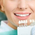Una mujer sonríe en una prueba de color antes de un blanqueamiento dental en una clínica