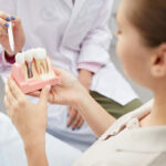 8 cosas que debo saber sobre los implantes dentales