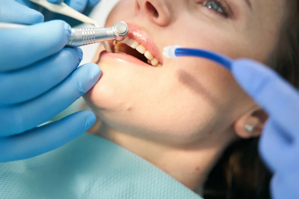 Dentista realizando tratamiento en los dientes de una paciente.