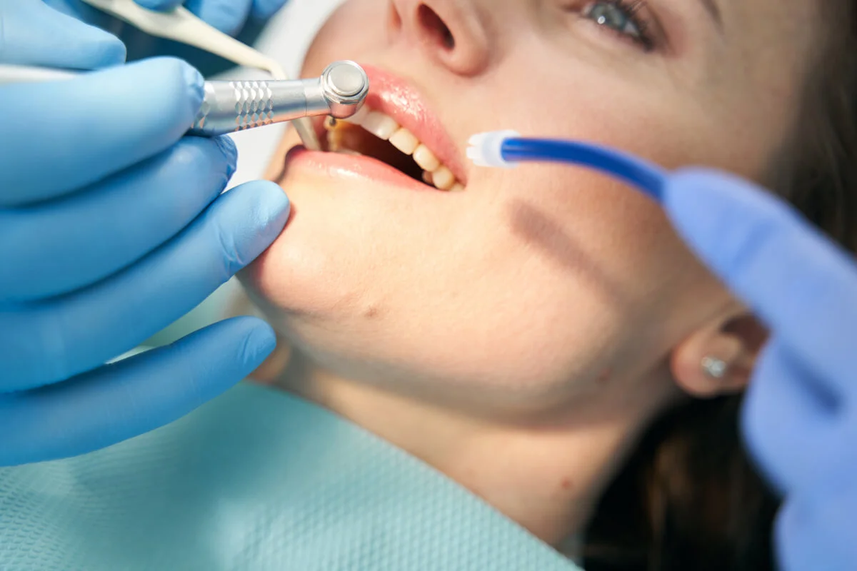 Dentista realizando tratamiento en los dientes de una paciente.