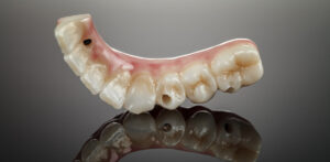 Ventajas y beneficios de las prótesis dentales 