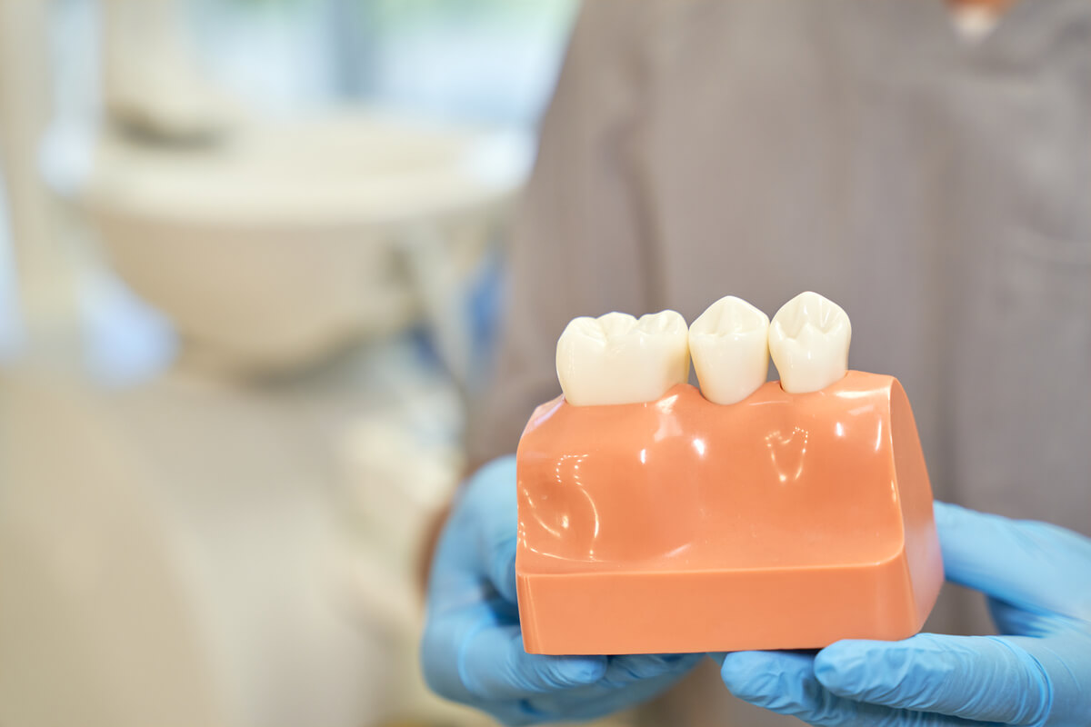 Periodoncia: ¿Qué es y cómo se realizan los tratamientos periodontales?