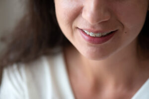 Ortodoncia en adultos para corregir maloclusión dental: ¿Cuál es la mejor opción?
