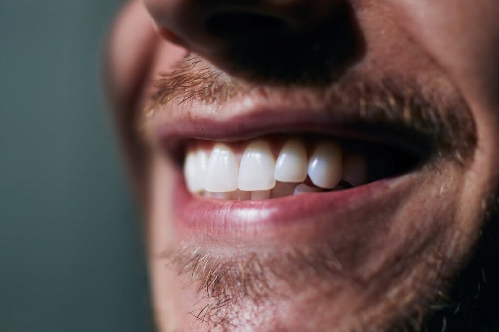 Cómo tener los dientes blancos siempre en 10 pasos