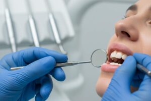 ¿Cómo se cura la gingivitis tratamientos que funcionan en adultos