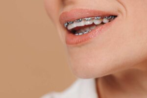 ¿Merece la pena la cirugía ortognática?