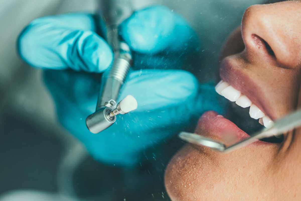 Cada cuánto hay que hacerse una limpieza dental