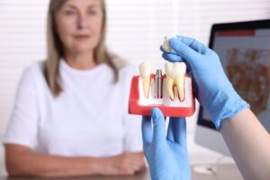 ¿Es normal que se mueva un implante dental