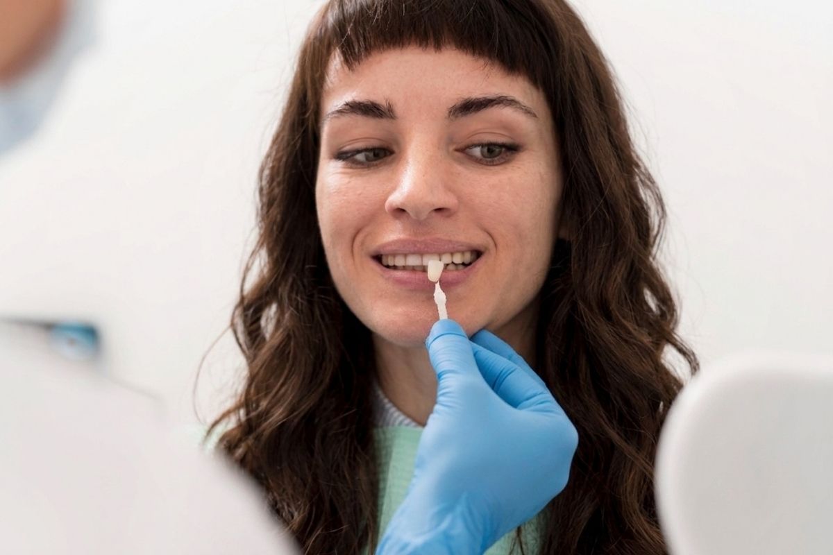 se pueden poner carillas si faltan dientes