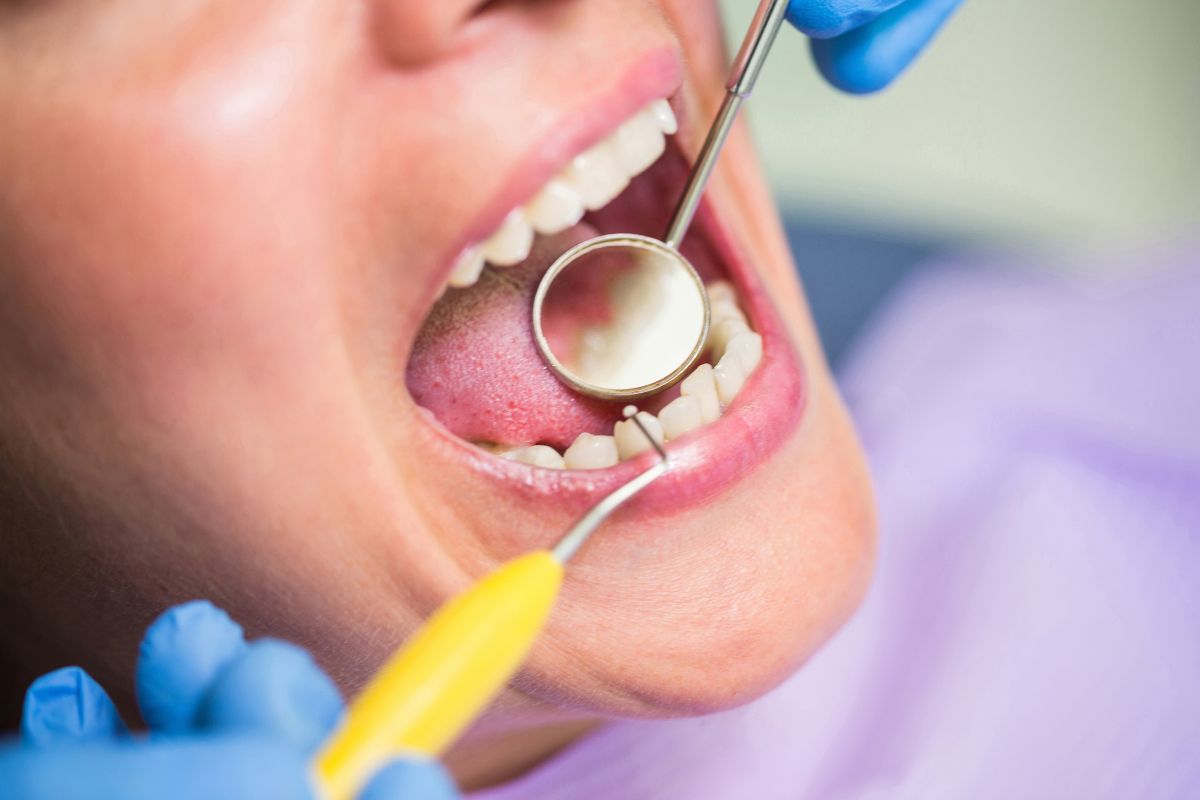 Piorrea dental