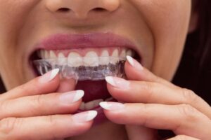 fundas dentales